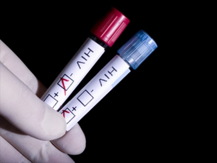 Studenţii îşi pot face GRATUIT testul HIV