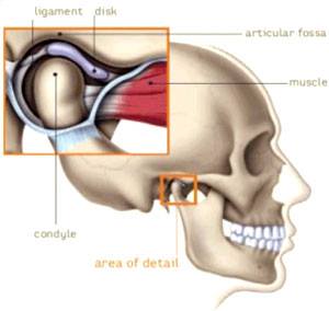 Disfunctia articulatiei temporo-mandibulare - Kinetic