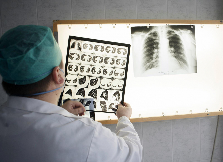 Legea tuberculozei, aplicată la doi ani de la promulgare