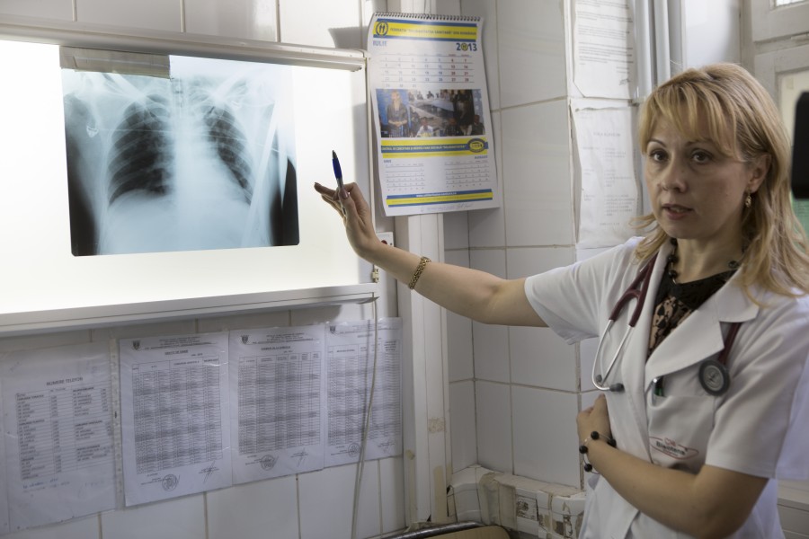 Salvat de medicii gălăţeni! Gălăţeanul străpuns de o bară de fier îşi revine după operaţie