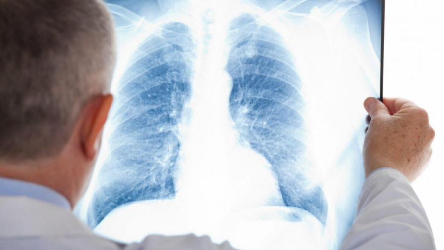 Fonduri pentru tratamentul tuberculozei