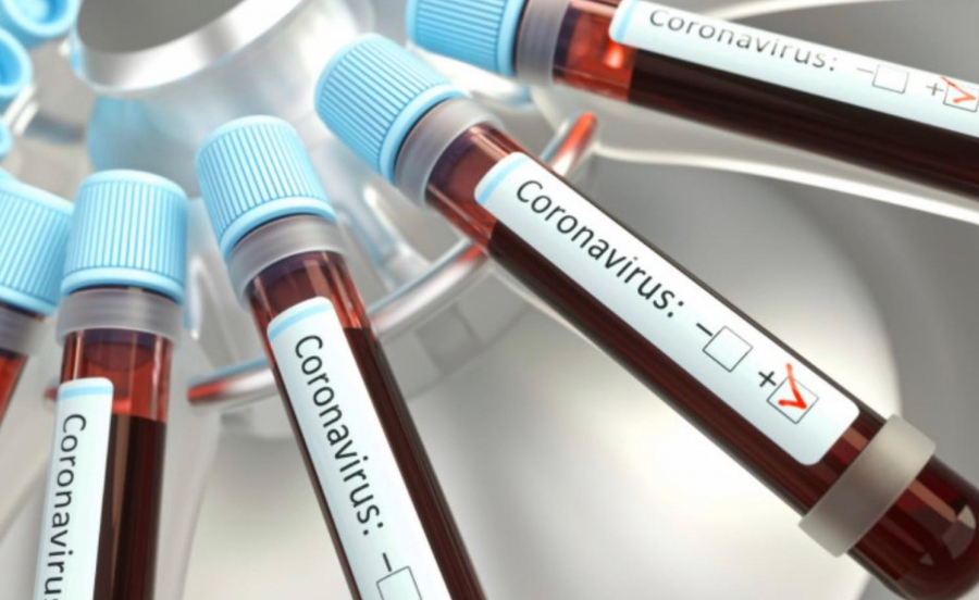 Încă 30 de infectări și un deces din cauza coronavirusului