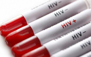 Fonduri pentru testarea pacienților cu HIV