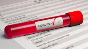 1.639 de cazuri noi și 41 de decese. 482 de persoane au fost reconfirmate cu coronavirus