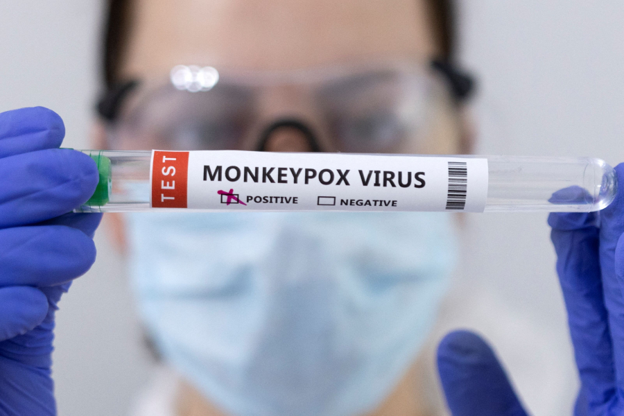 A fost diagnosticat al treilea caz de variola maimuței, în România