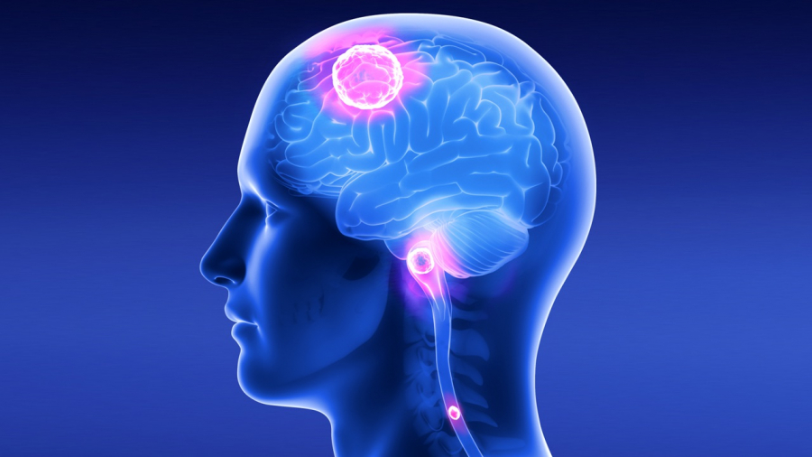 Verdețurile din dietă pot preveni bolile neurodegenerative