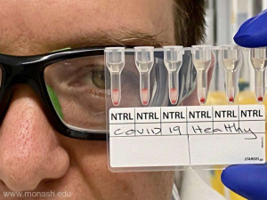 Test ultrarapid pentru coronavirus