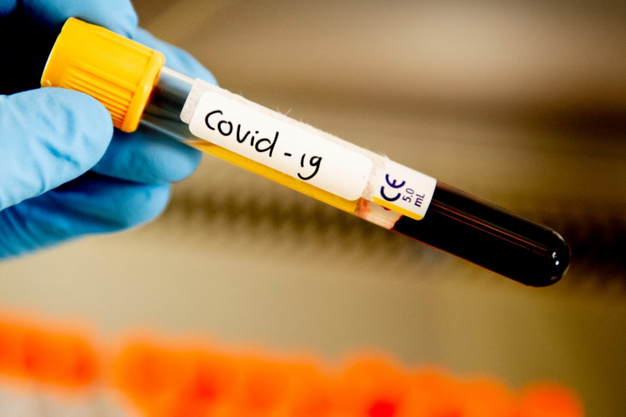 România se apropie de 100.000 de infectări cu noul coronavirus