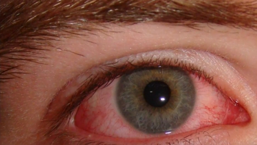 Coronavirusul poate afecta şi vederea