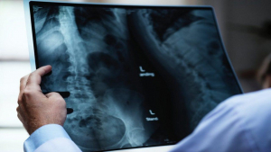 Fonduri pentru controlul tuberculozei în România