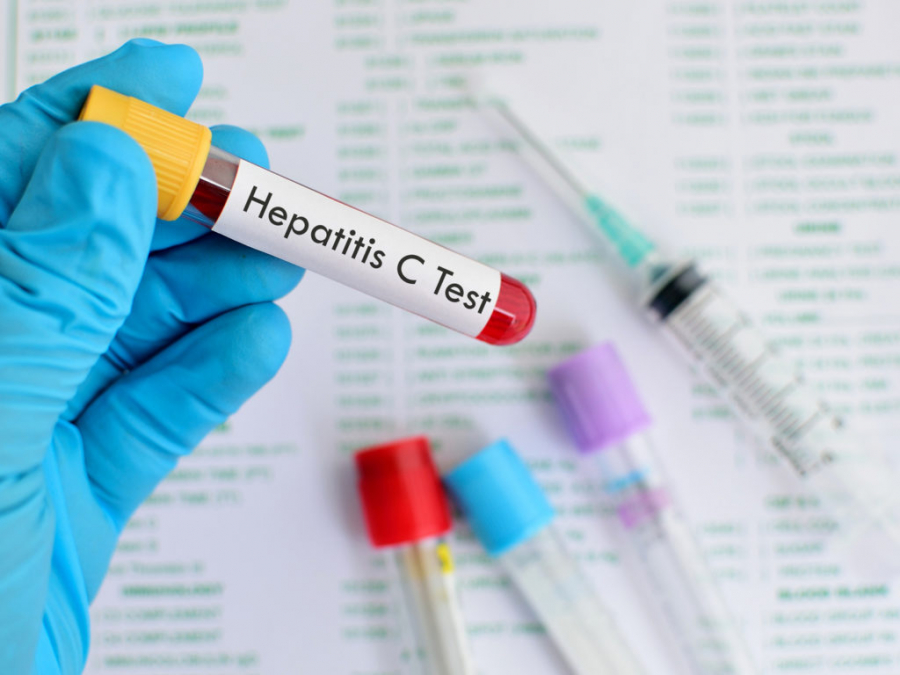 Testări gratuite pentru hepatită
