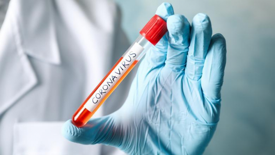 UPDATE 1.328 cazuri noi de infectare cu coronavirus în ultimele 24 de ore
