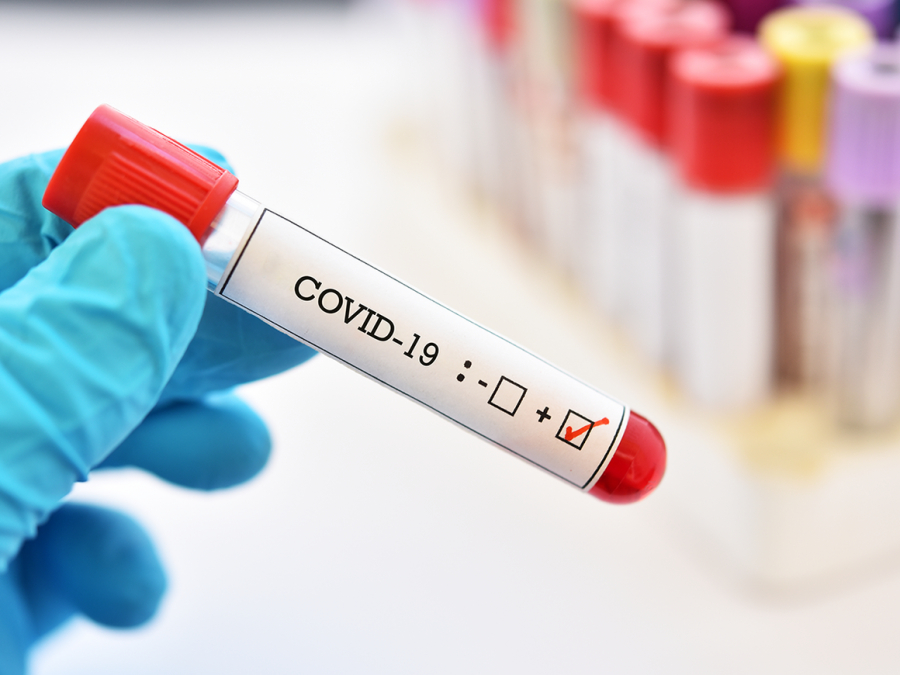 Tratamentul pe bază de anticorpi, ineficient în prevenirea COVID-19
