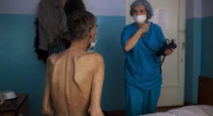 Câţi gălăţeni s-au îmbolnăvit de tuberculoză în 2012