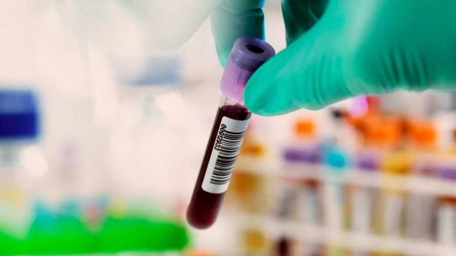 Galațiul, inclus într-un important program pentru hepatită