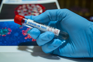 Coronavirusul va deveni puternic în următoarele luni, avertizează OMS