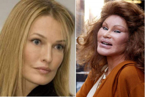 „Catwoman” a murit  la 84 de ani. Cheltuise miliarde pe operații estetice