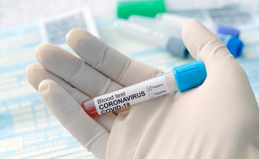 UPDATE BILANȚ | Încă 401 români au fost infectați cu coronavirus