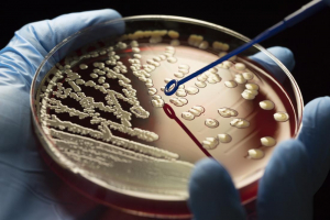 Cum dezvoltă bacteriile rezistență la antibiotice