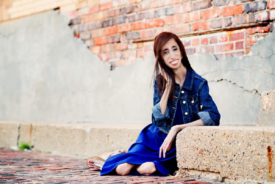 Învăţăturile celei mai urâte femei din lume, Lizzie Velasquez