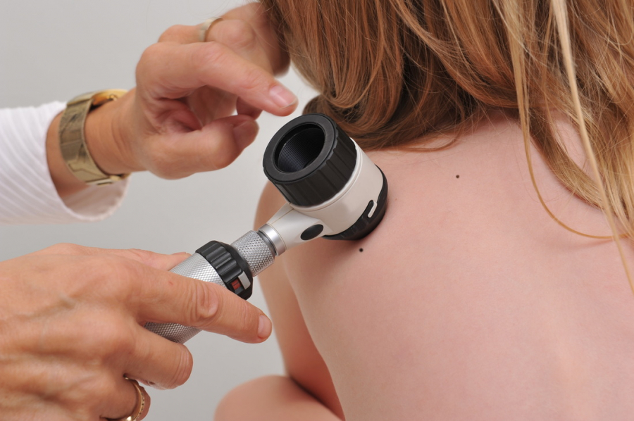 Consultaţii GRATUITE pentru depistarea cancerului de piele