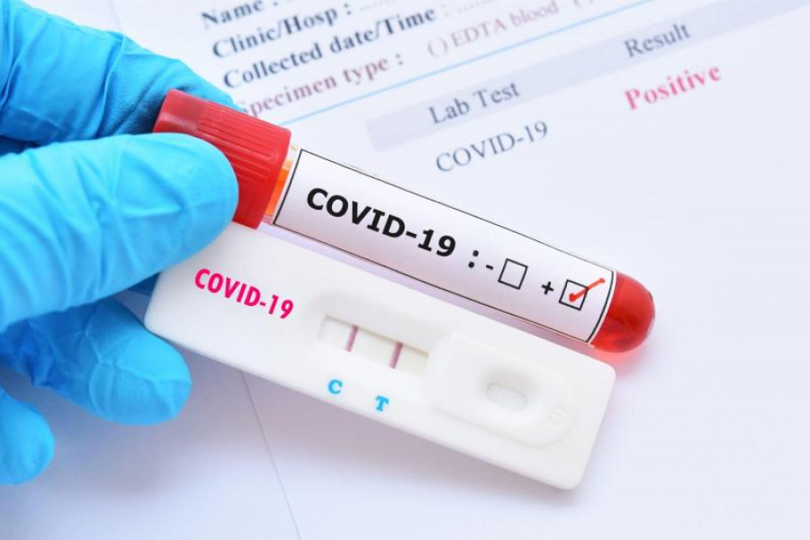 Pandemia de COVID-19, la nivel național: Mai puțin de 900 de cazuri noi, în ultimele 24 de ore