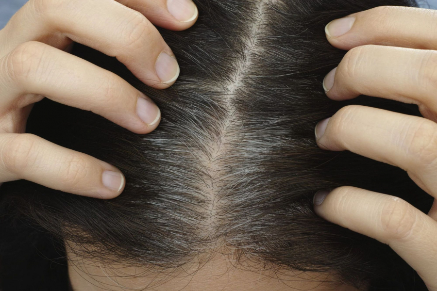 Metode de ajutor pentru stoparea albirii părului