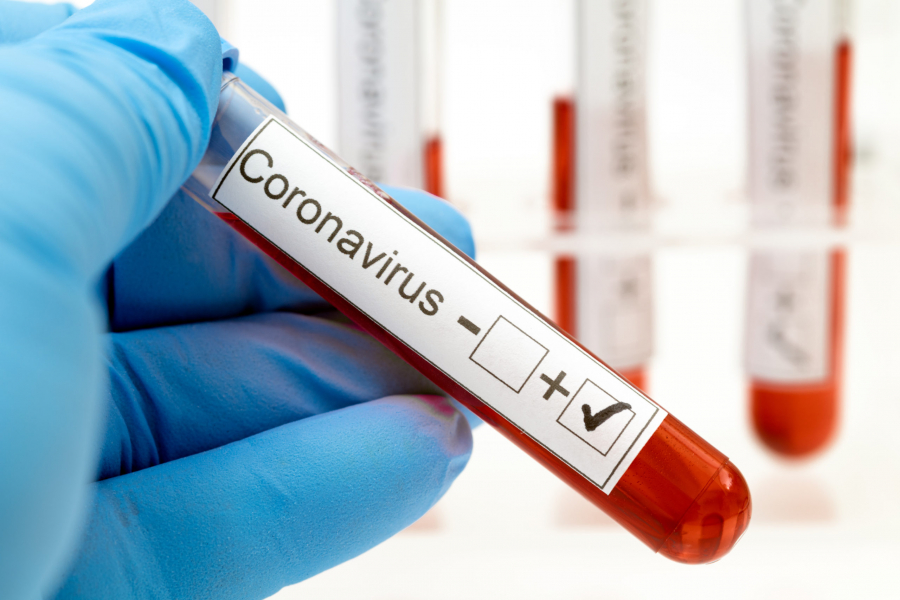 Record de infectări cu noul coronavirus la nivel naţional