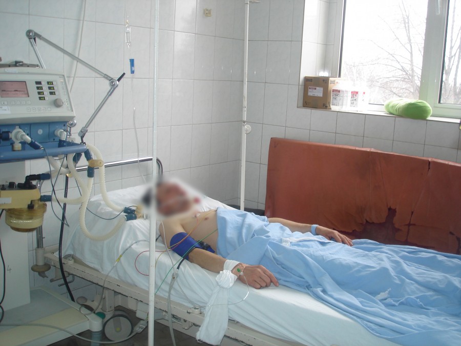 Un bărbat a ajuns în comă la spital după ce a băut otravă