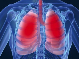 Bronhopneumonia obstructivă cronică, boala care ne „fură” aerul