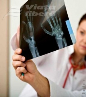 Gălăţenii şi povara osteoporozei 