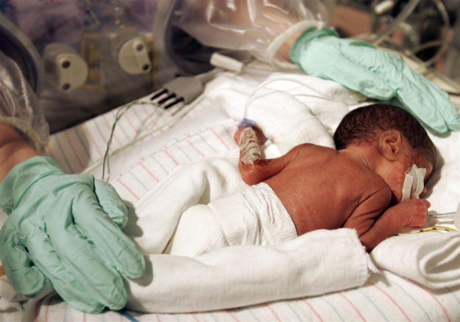 Mortalitatea infantilă, la cote ridicate