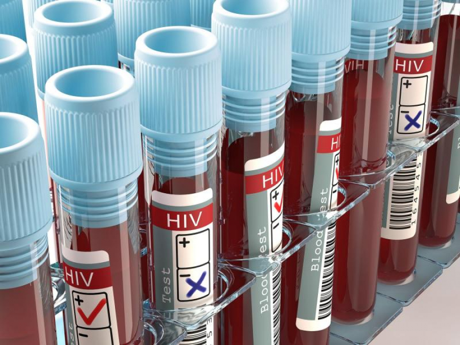 O femeie, cea de-a treia persoană din lume vindecată de HIV