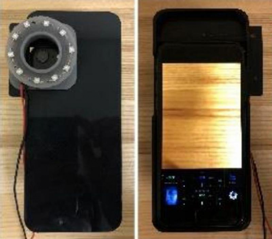 Camera foto cu detector de microbi - următoarea dotare la modă pentru produsele smartphone