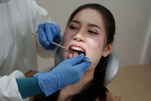 Tipuri de oglinzi dentare și aplicațiile lor &icirc;n stomatologie