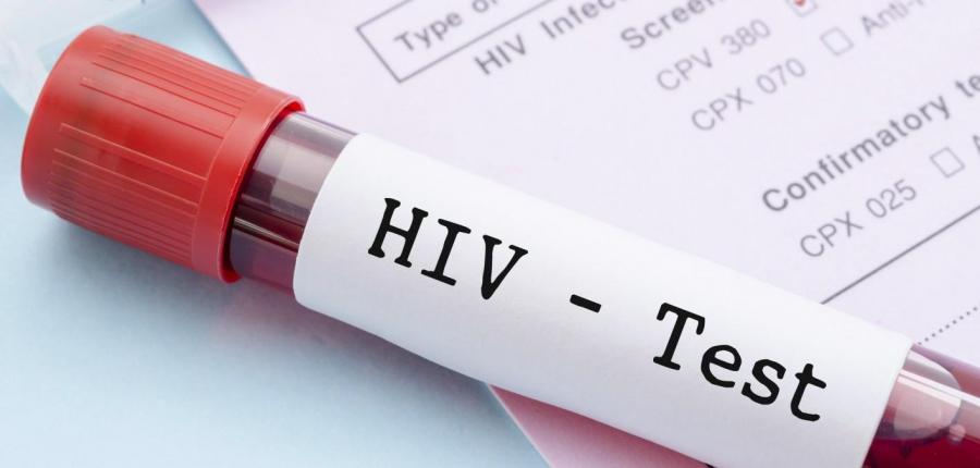 Proiect privind infecţiile cu HIV/SIDA, în dezbatere publică