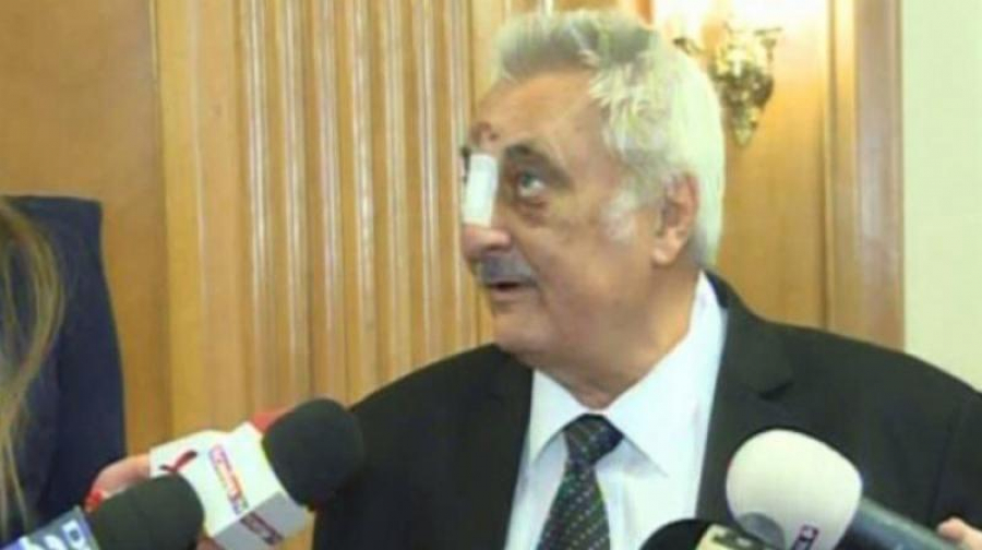 Politică şi durere. Bacalbasa a ajuns în Parlament cu nasul rupt