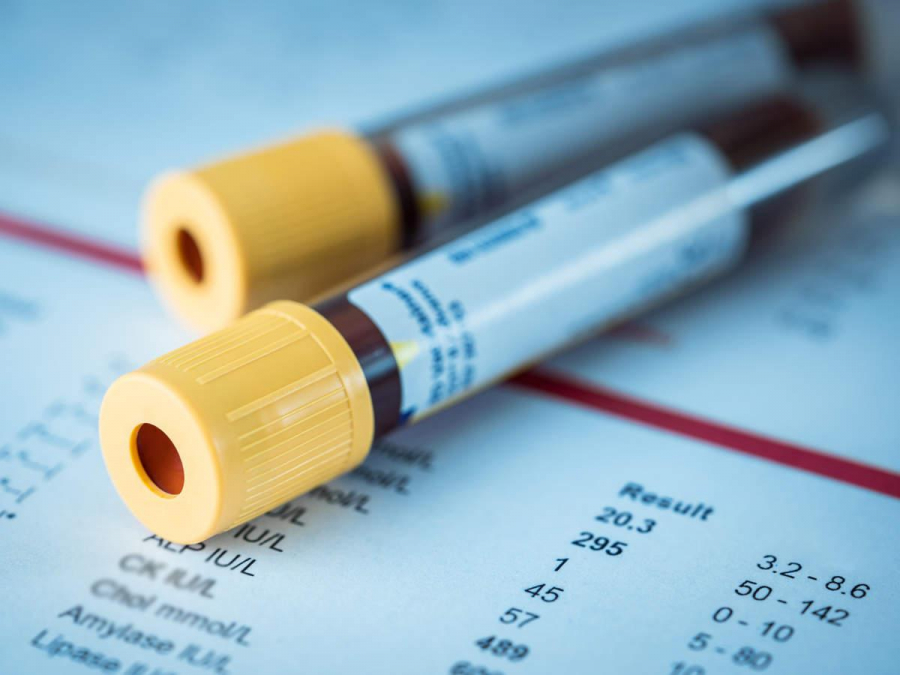 Un test de sânge ar putea detecta cancerul