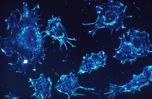 Celulele canceroase își ”corup” vecinele