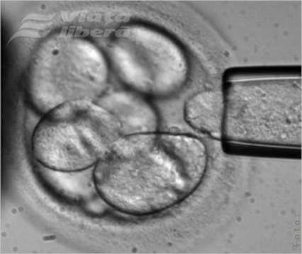 Transplantul de celule stem