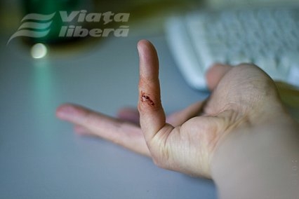 Bărbat „văduvit” de trei degete 