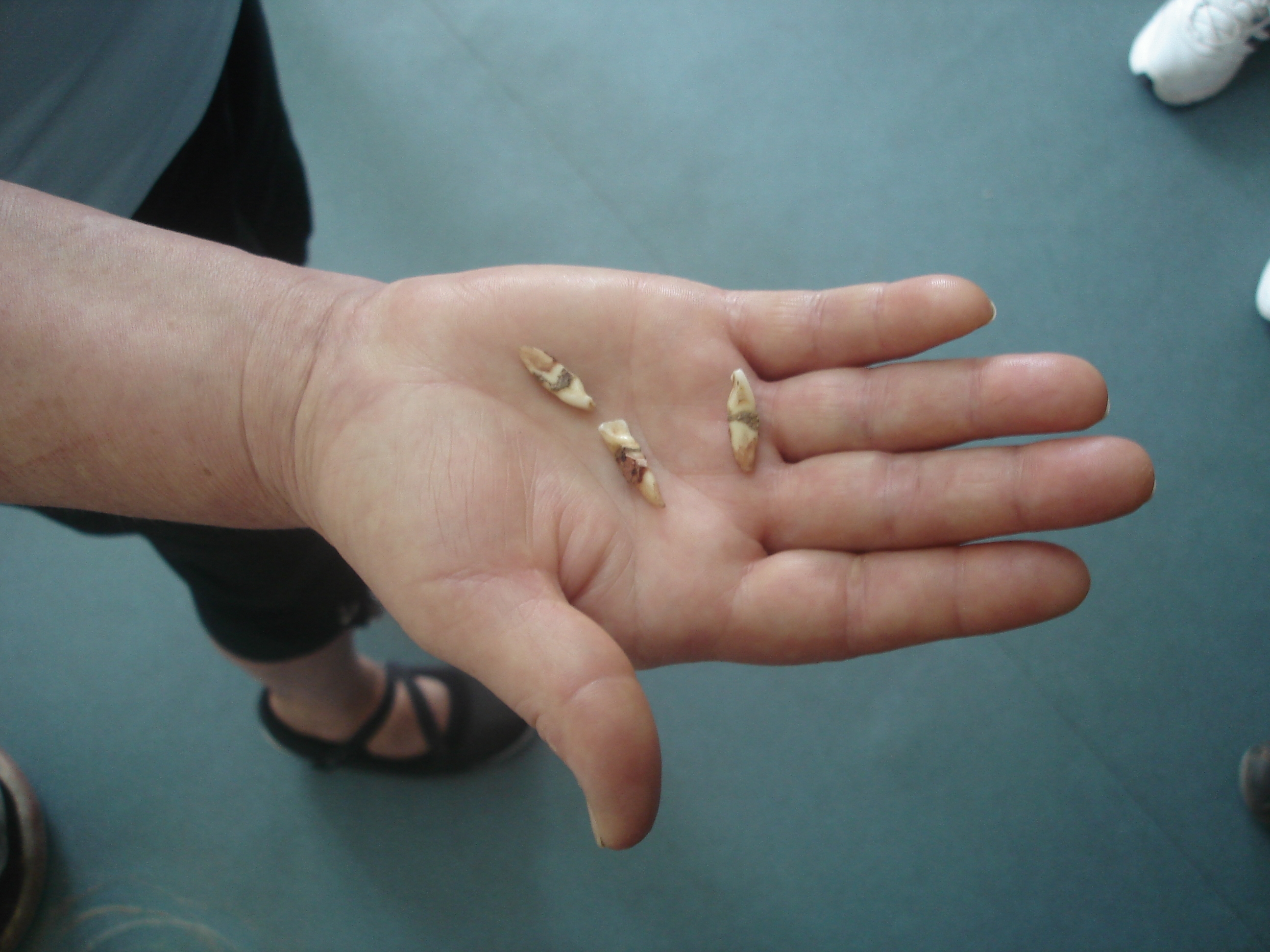 Tânăr bătut până şi-a înghiţit dinţii