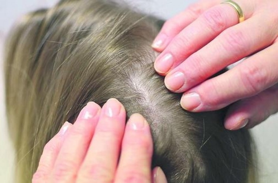 CONTROALE MEDICALE ÎN ŞCOLI - Elevii gălăţeni, căutaţi de păduchi şi râie