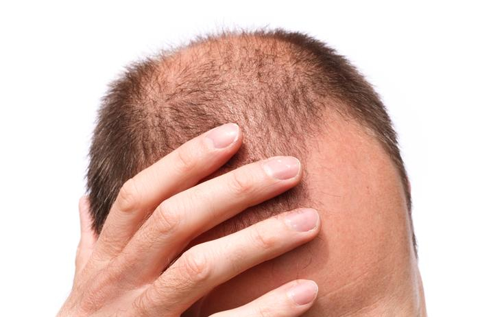 Orele suplimentare afectează podoaba capilară