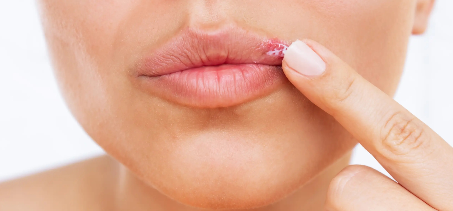 Spune adio herpesului cu ajutorul L-lizinei!