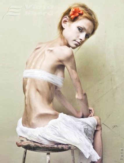 Adolescenţa şi pericolul anorexiei