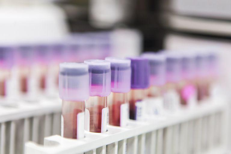 Autorităţile promit noi programe de sănătate în oncologie