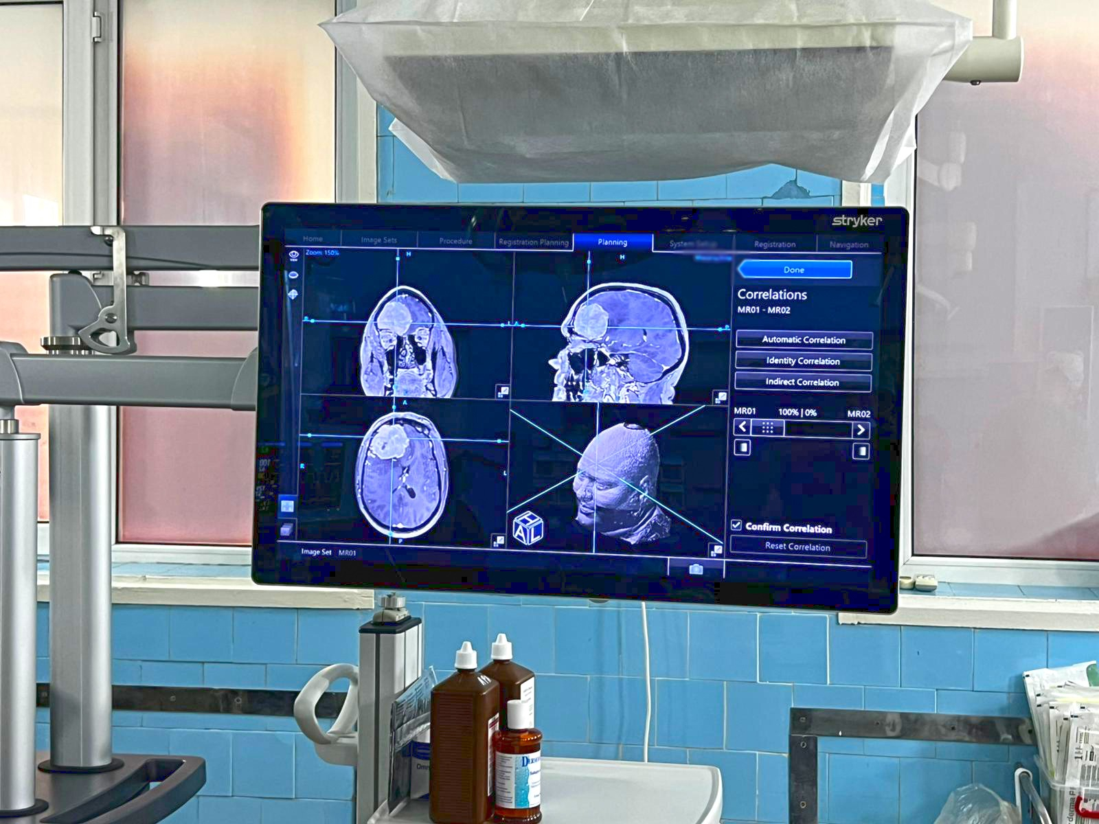 Premieră medicală în neurochirurgie - La Spitalul Județean Galați, prima operație pe creier realizată cu ajutorul Sistemului de Neuronavigație