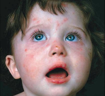 Copiii, insuficient vaccinaţi