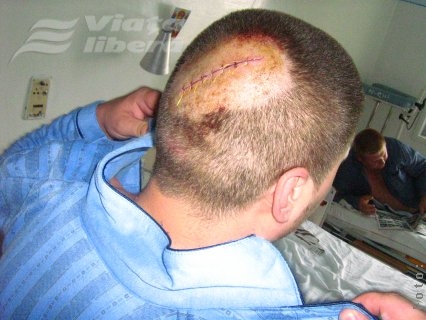 Bătaie cu patru picioare 